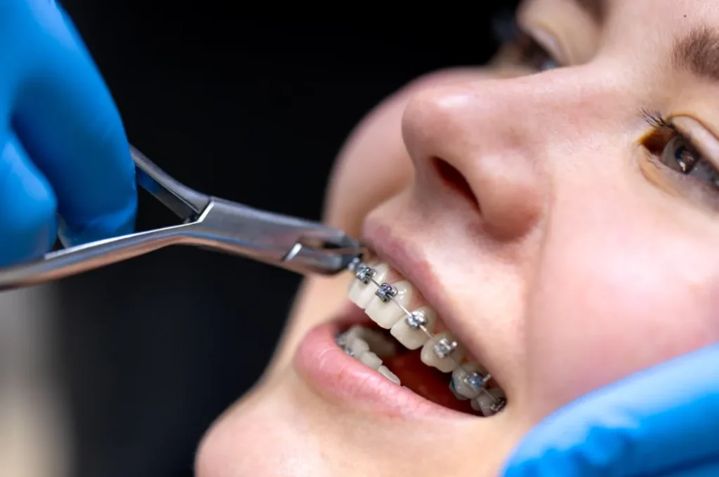 How Cosmetic Dentistry Pairs With Orthodontics For Complete Care