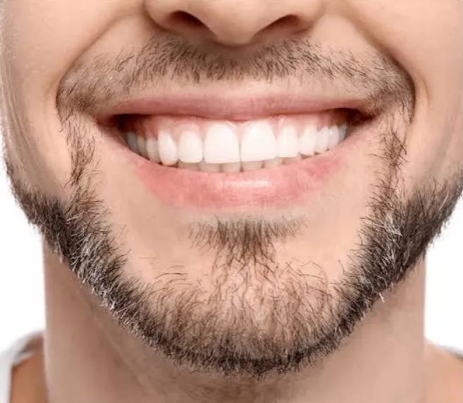 6 Smile Care Tips For Protecting Veneers, Crowns, And Whitening Results 6 Smile Care Tips For Protecting Veneers, Crowns, And Whitening Results