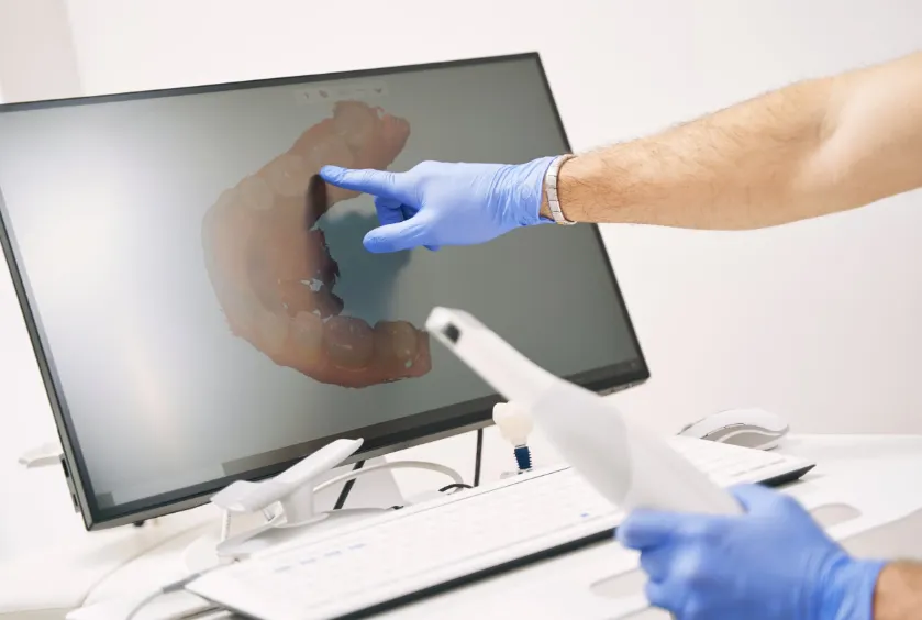 Why Digital Impressions Provide Better Accuracy Than Traditional Methods Why Digital Impressions Provide Better Accuracy Than Traditional Methods