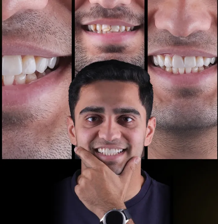 Why General Dentistry Creates The Ideal Base For Smiles Designs Why General Dentistry Creates The Ideal Base For Smiles Designs